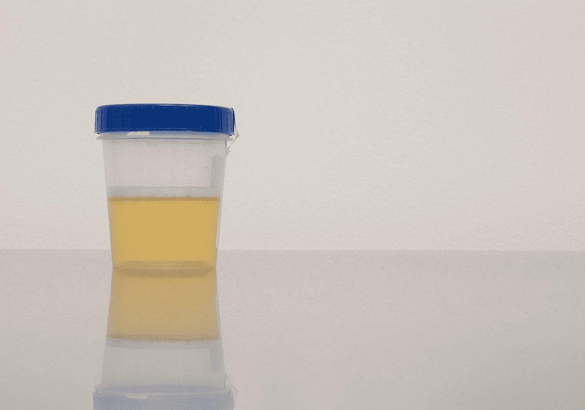 Drug testing work from home employees