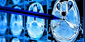 Brain scans are analyzed with the help of artificial intelligence in healthcare.