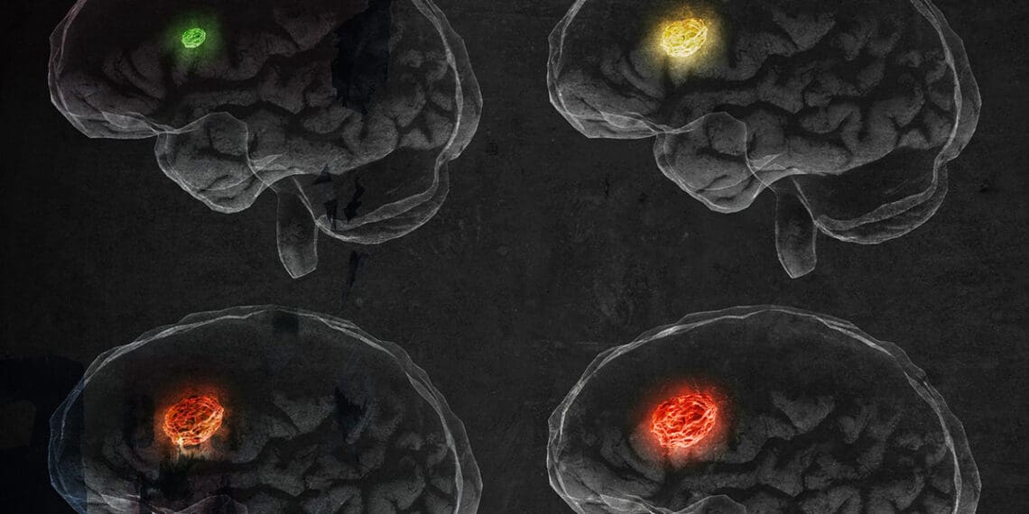 scan of different brain types