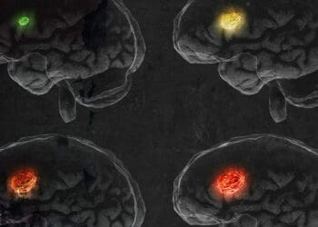 scan of different brain types