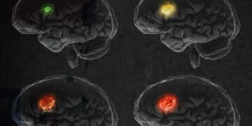 scan of different brain types